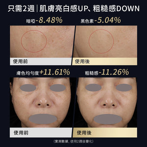 YAMAN YA- MAN 綠光面罩.