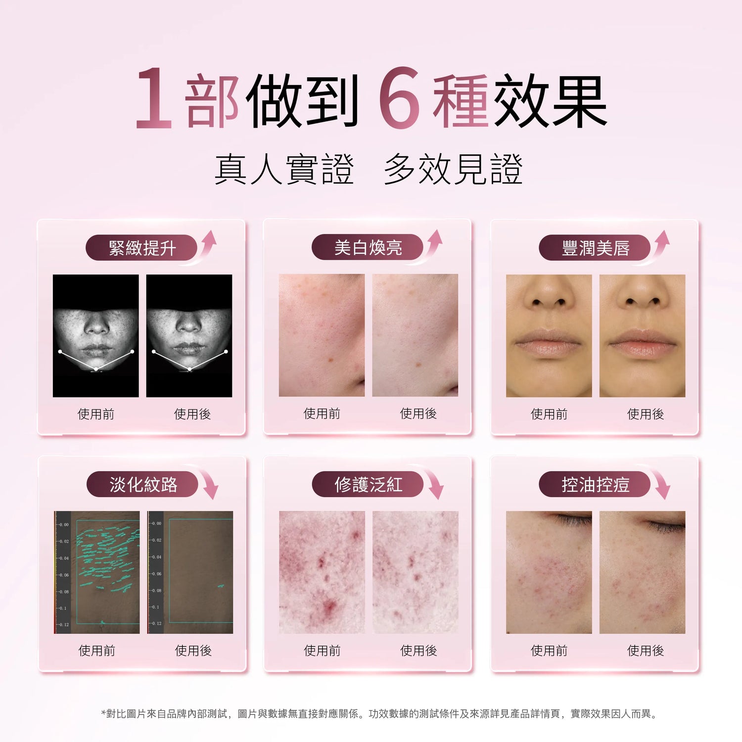 YA-MAN 閃修儀Pro 智能升級 微電流美容儀 16頻進階提拉 APP多模式 眼臉口周精護