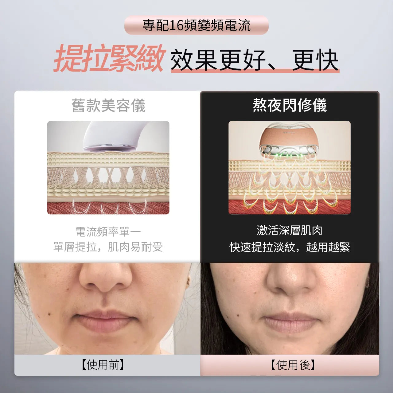 YA-MAN 熬夜閃修儀 微電流美容儀 急護消腫 三大模式 一機多用