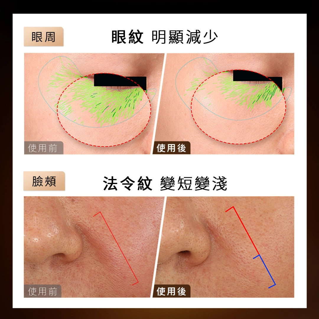 YAMAN YA-MAN ACE五代.