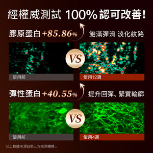 YAMAN YA-MAN ACE 六代【Bloom 6】.