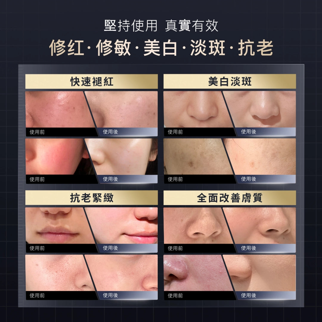 YAMAN YA-MAN 光愈面罩.