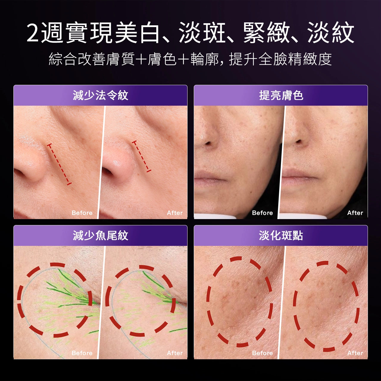 YAMAN YA-MAN MAX 三代.